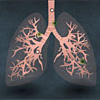 smoking-lung